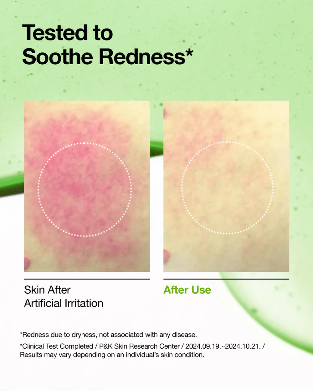 Anua Azelaic Acid 10 + Hyaluron Redness Soothing Serum 30ml