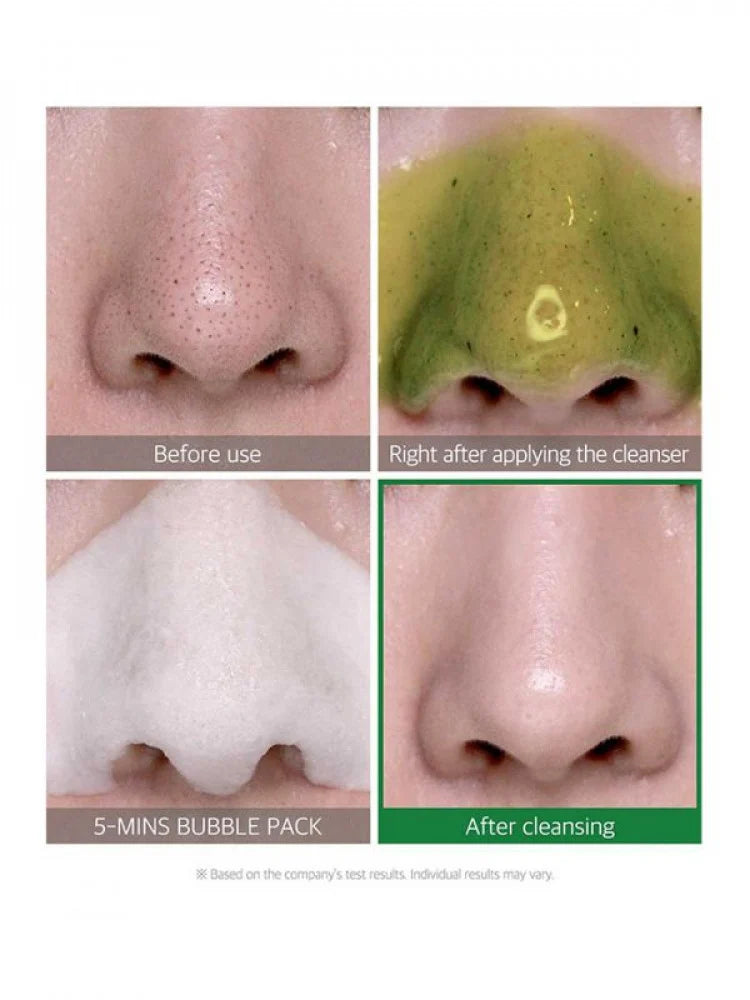 BYEBYE BLACKHEAD 30 Days Miracle Green Tea Tox Bubble Cleanser 120 g