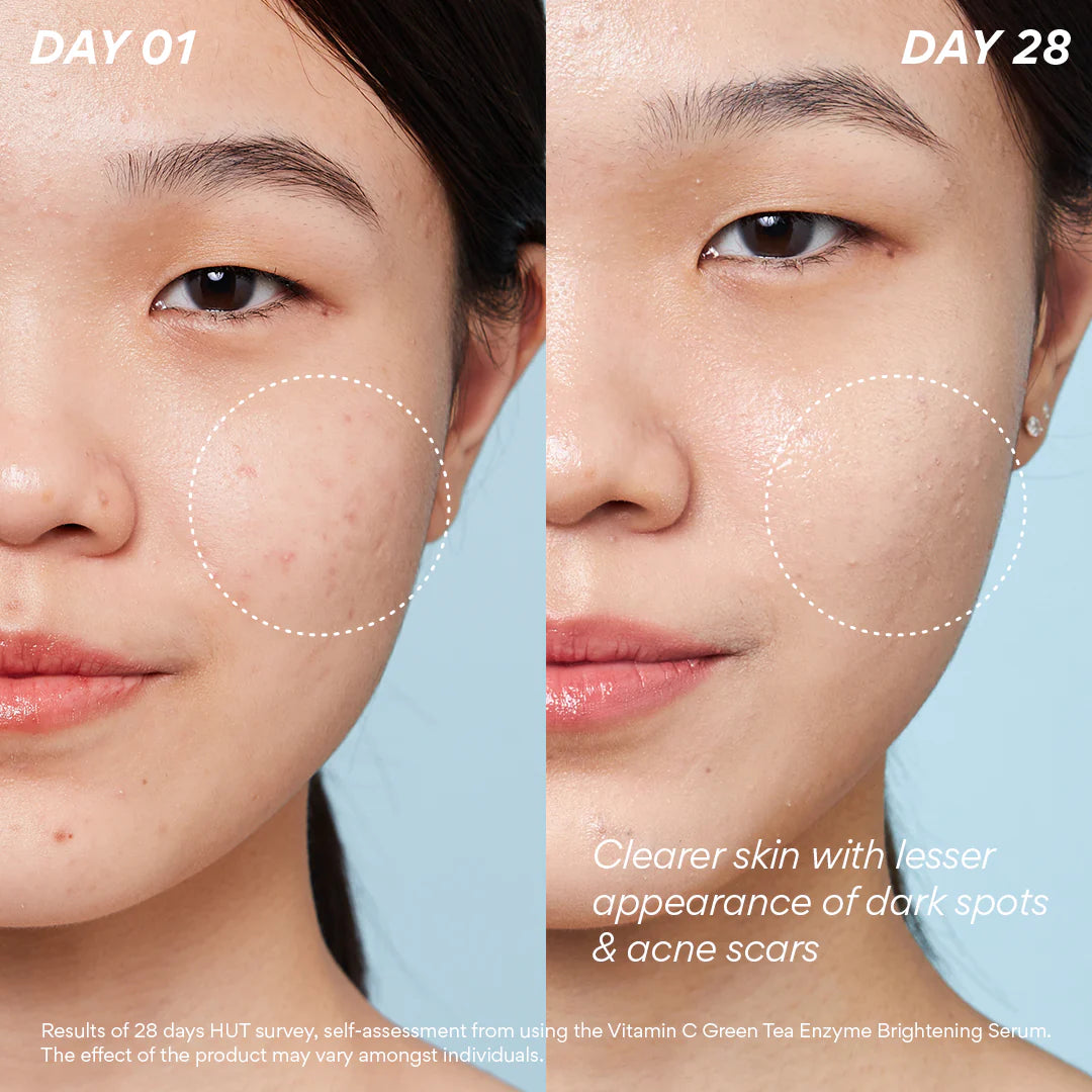 Innisfree Vitamine C Green Tea Enzyme Brightening Serum 30 ml