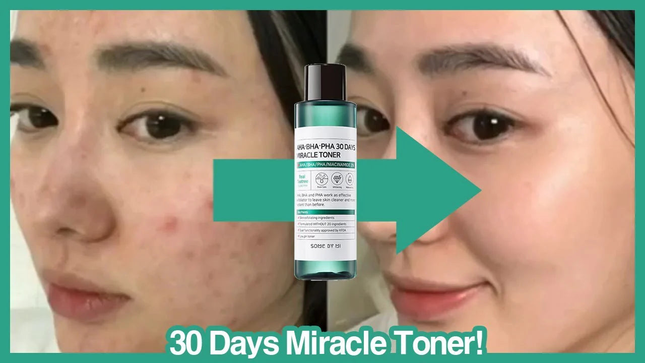 AHA BHA PHA 30 days Miracle Toner 150ml