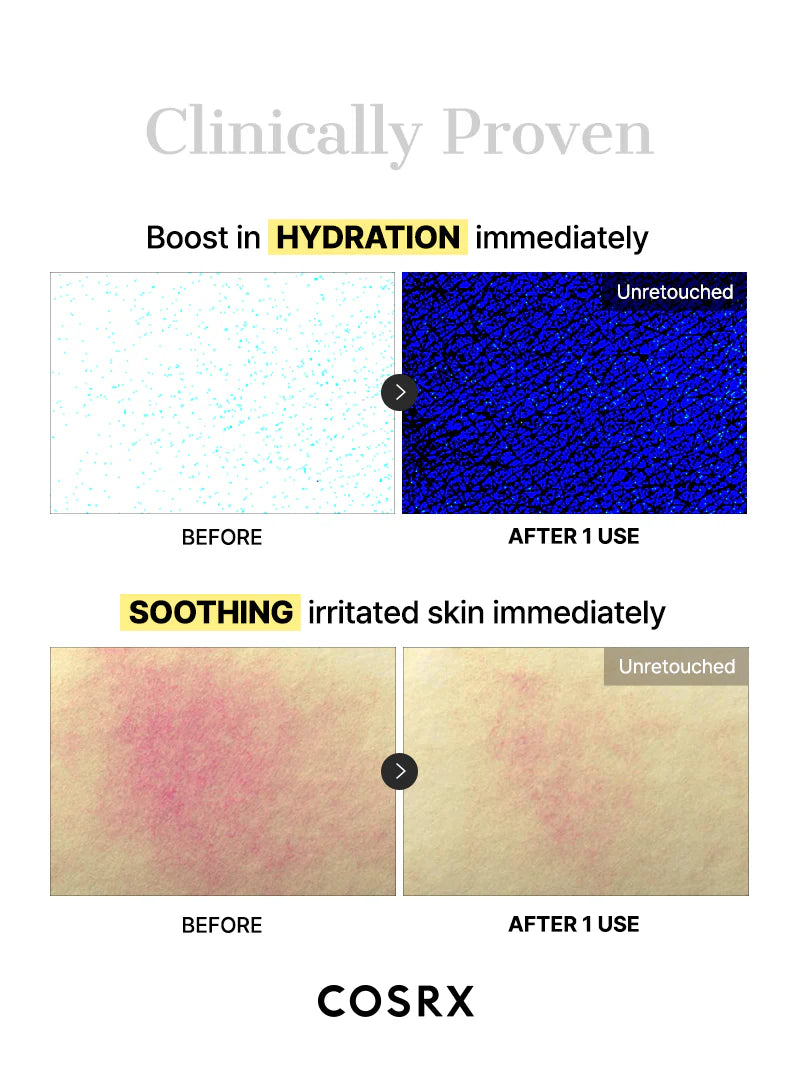 Advanced Snail Mucin Glass Glow Hydrogel Mask 3ea