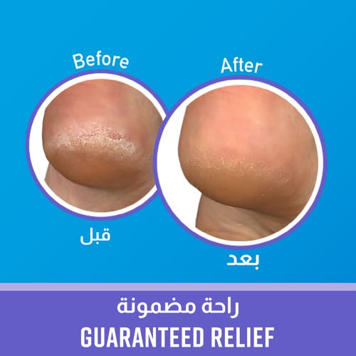 O'KEEFFE'S Healthy Feet Night Treatment 85 g